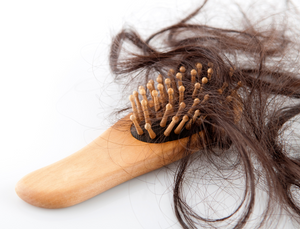 How To Naturally Prevent Hair Loss